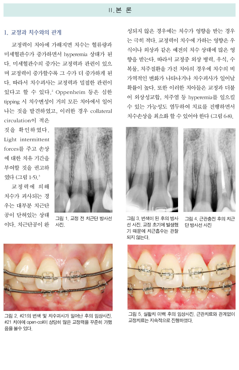 기고3_3