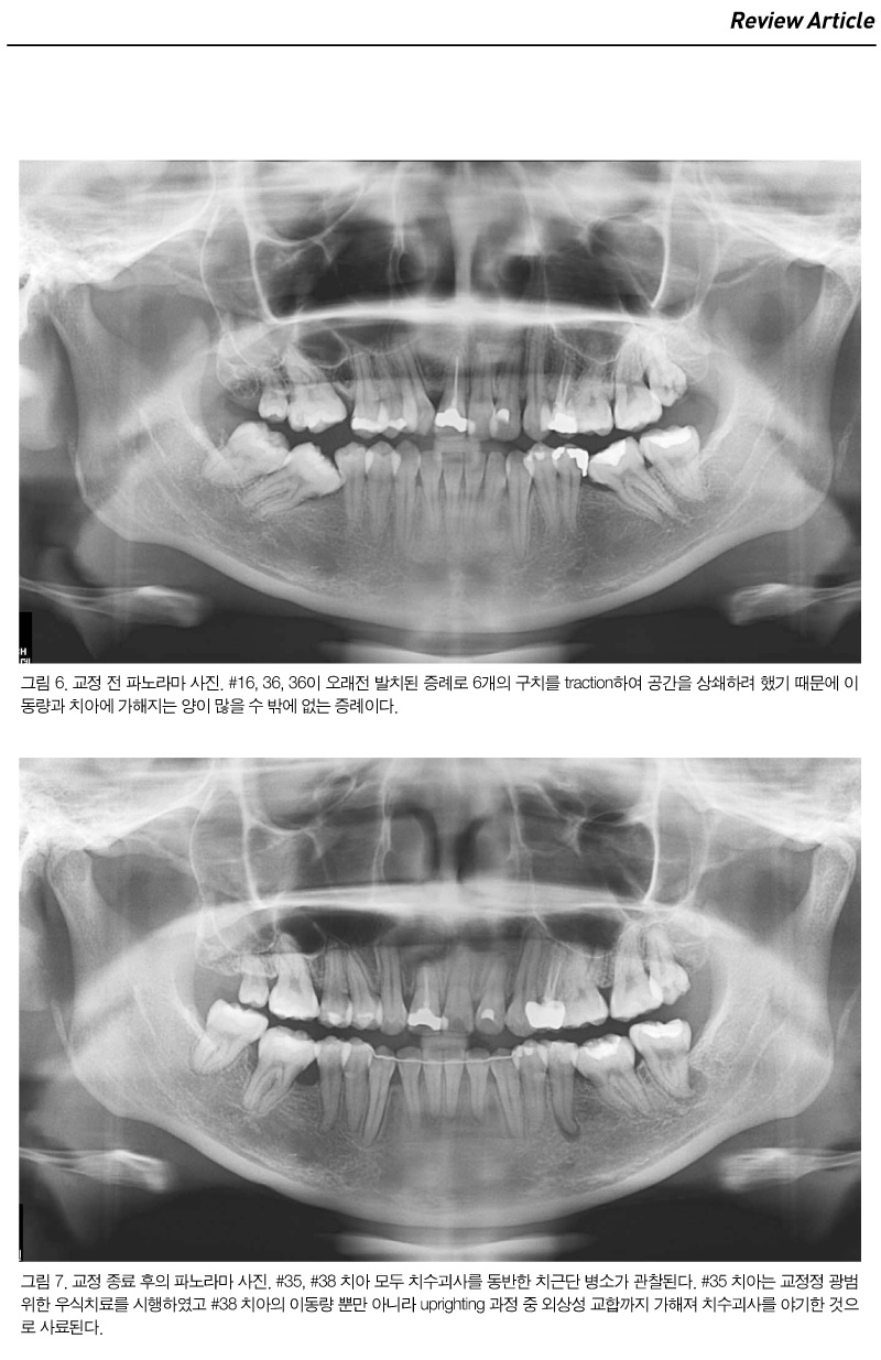 기고3_4