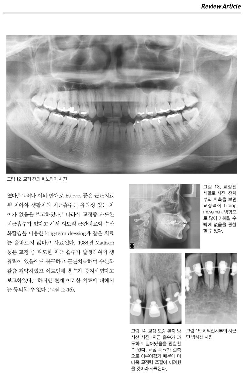 기고3_6