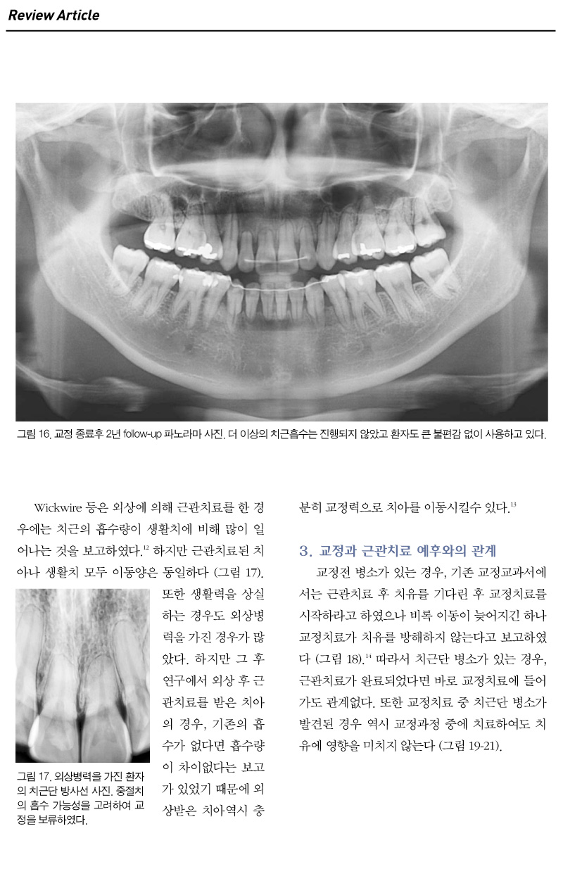 기고3_7