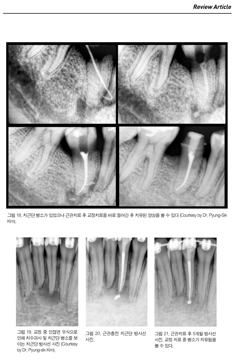 기고3_8