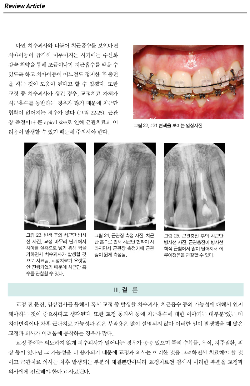 기고3_9